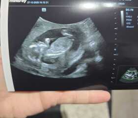 Girl or boy??