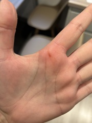 Help me to identify this mystery thing on my skin!!