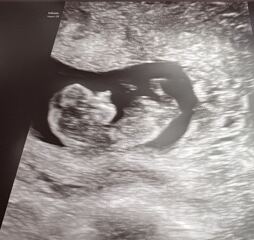 Gender guesses please