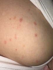 Weird Skin Rash?!