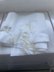38+5 weeks pregnant mucus plug TMI