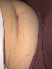 Weird Skin Rash?!