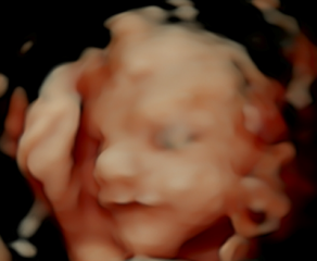 Pregnant with first baby