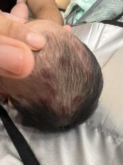 baby rashes. doctors don’t know what it is