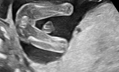 Is this definitely a girl?