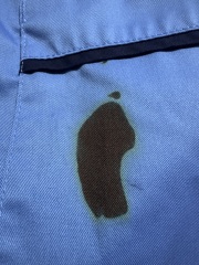 Ink stains on nhs uniform