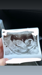 DP hoping for a girl… 12 week scan suggests otherwise?
