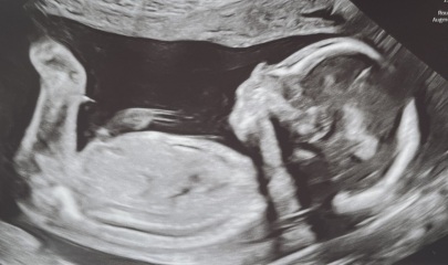 Boy or girl?