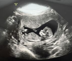 Nub theory - early glimpse