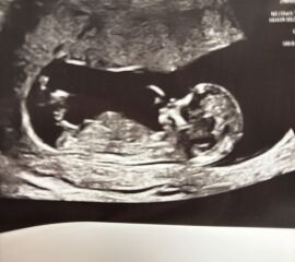 Nub theory - early glimpse