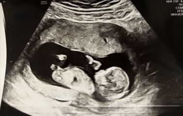 Due July 2026 🤍