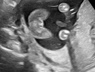 Is this definitely a girl?