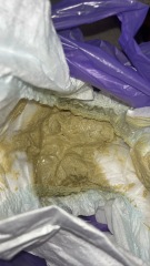 Poorly 4 month baby, pale poos!?