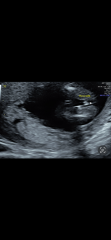 Does scan confirm baby girl?