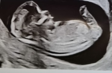 Boy or girl???