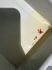 5 weeks pregnant, does this look like a miscarriage?