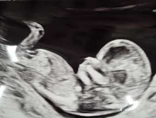 Gender guesses