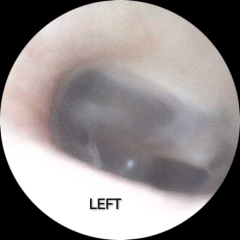 Ear Issues