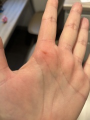 Help me to identify this mystery thing on my skin!!