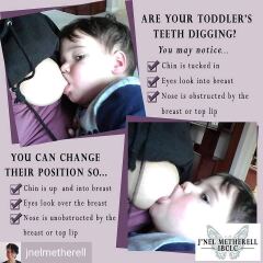 Breastfeeding pain - latching with teeth