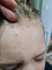 Dd (9) keeps getting odd looking spots