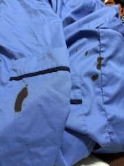 Ink stains on nhs uniform
