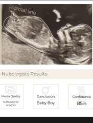 Opinions on nun theory