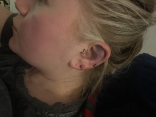 Ear damage - does this require medical attention?