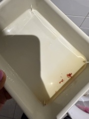 5 weeks pregnant, does this look like a miscarriage?