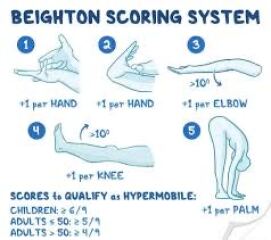 5yo DD suddenly having nosebleeds – reassurance please