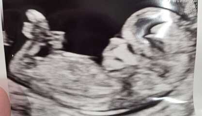 Gender guesses