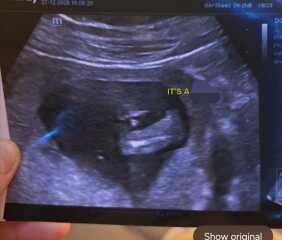 Girl or boy??