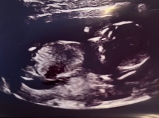 Gender guess- 15 weeks