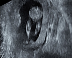 Boy or girl?