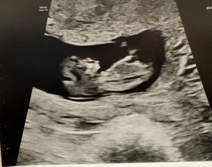 Gender guesses please