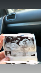 DP hoping for a girl… 12 week scan suggests otherwise?