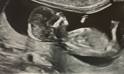 Boy or girl?