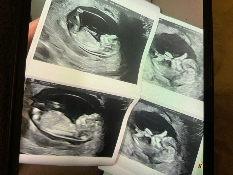 12 weeks 5 days