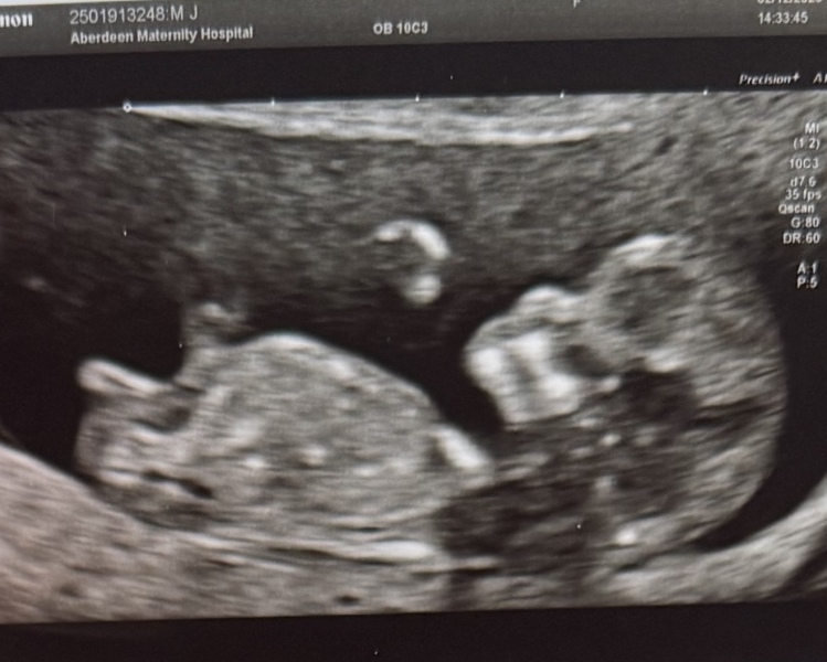 Boy or girl