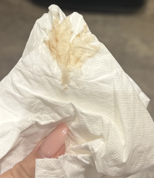 Is this normal? Discharge at 7 weeks pregnant [pic included]