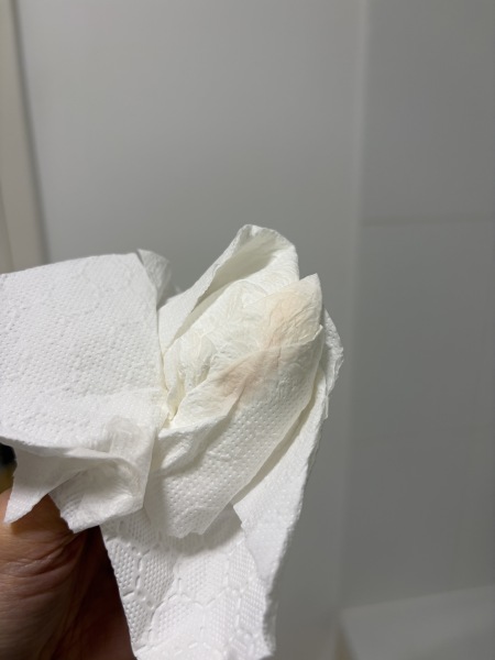 Is this implantation bleeding?? Photo