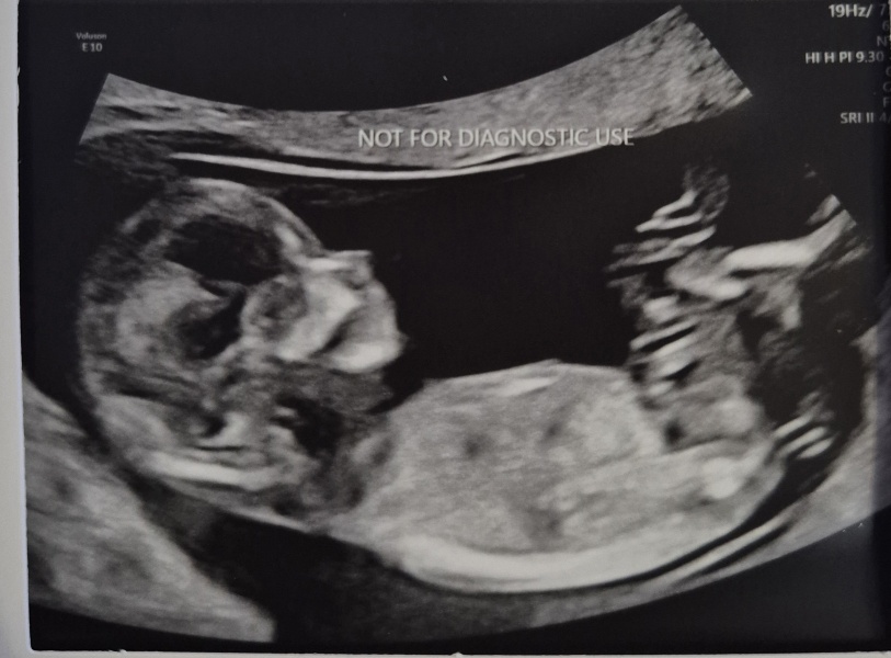 Boy or girl?