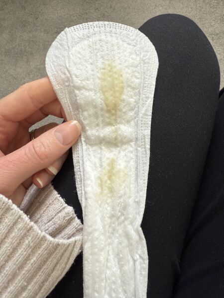 TMI Pic Included - 28 weeks. Would you worry about this discharge?