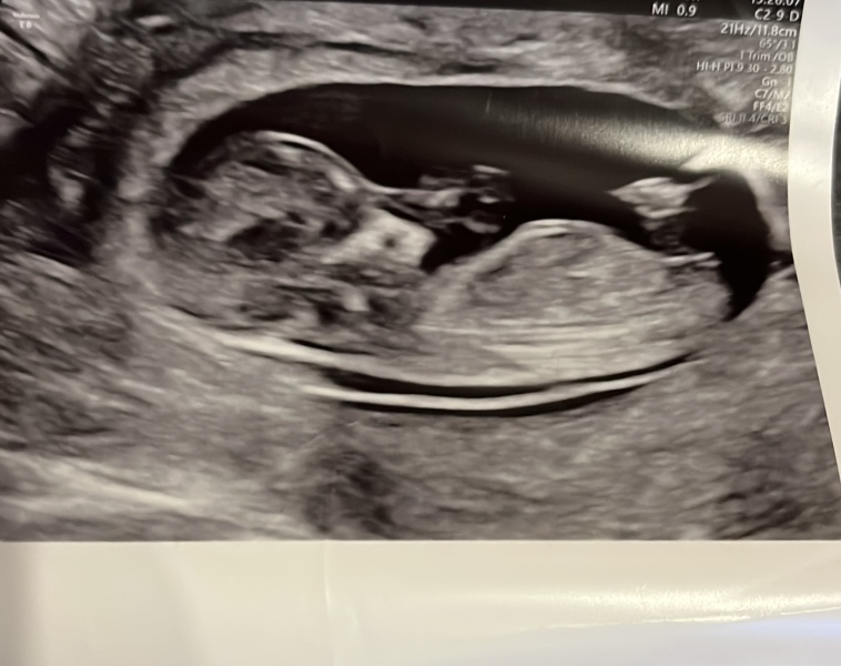 Boy or girl