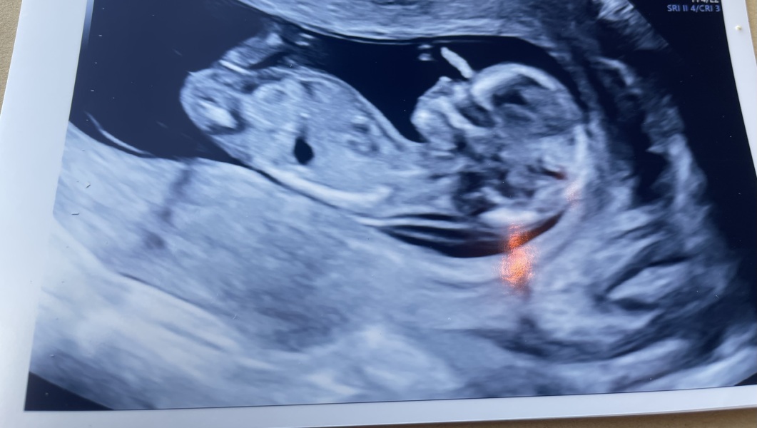 Gender guesses?