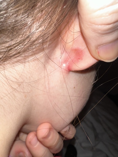 To ask for your help with DD’s ear??  Pic attached.