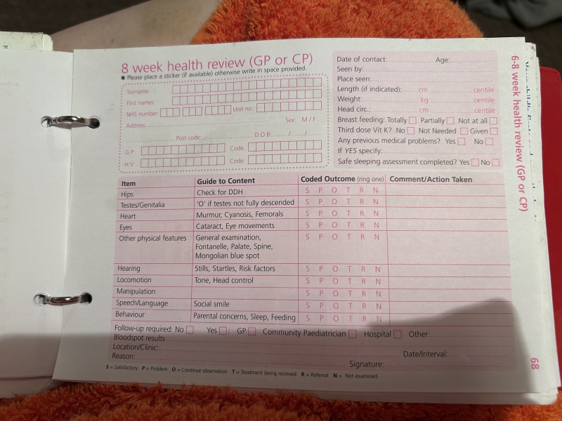 Has anyone son ever had to have orchidoplexy surgery?