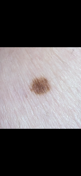 Mole
