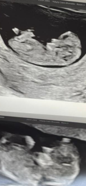 Any guesses for fun at 10 weeks 4 days