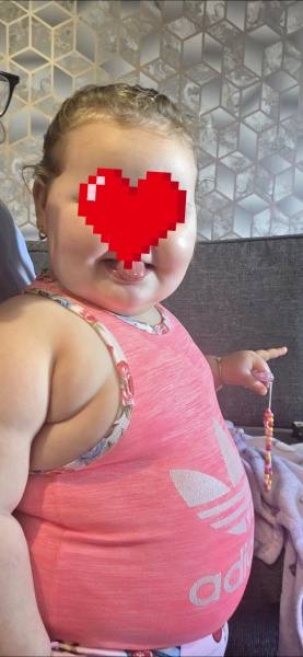 Has anyone else's child had this